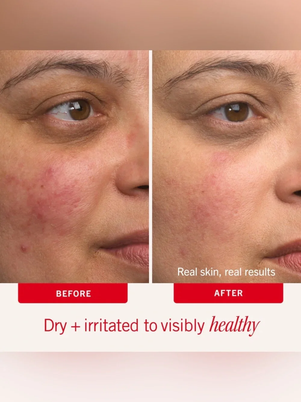 FIRST AID BEAUTY Ultra Repair Cream Intense Hydration